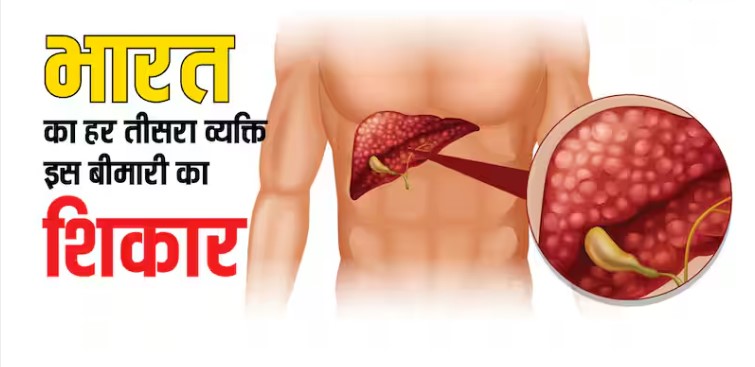 Every third Indian is in the grip of this dangerous disease, know what is this disease